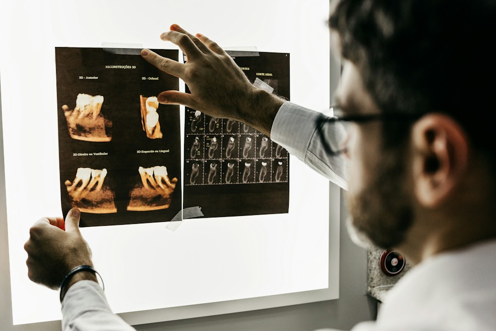 Paciente reabilitada com Prótese Protocolo Fixo sobre Implantes na VK Odonto Cotia